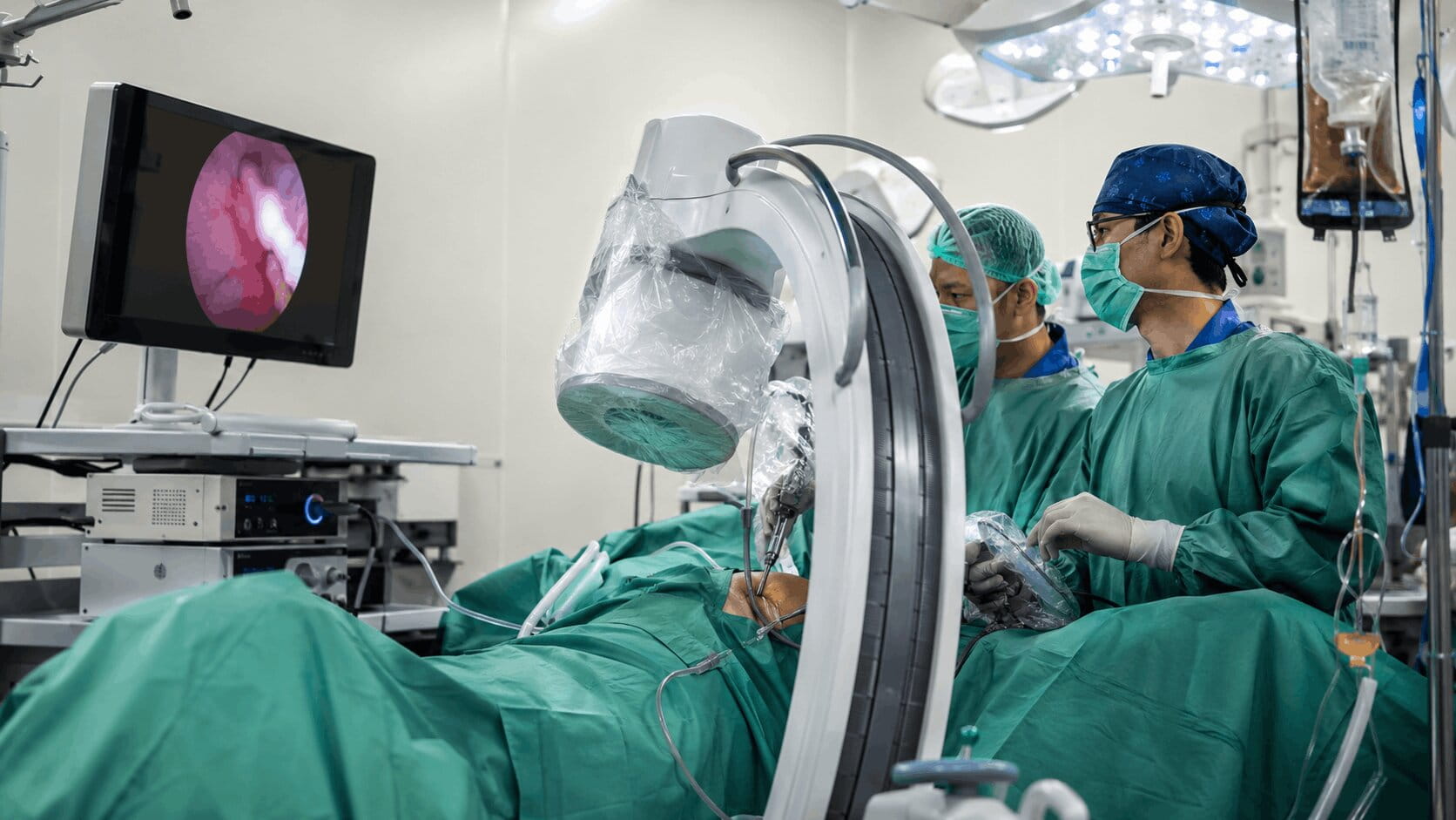RIRS Retrograde Intrarenal Surgery